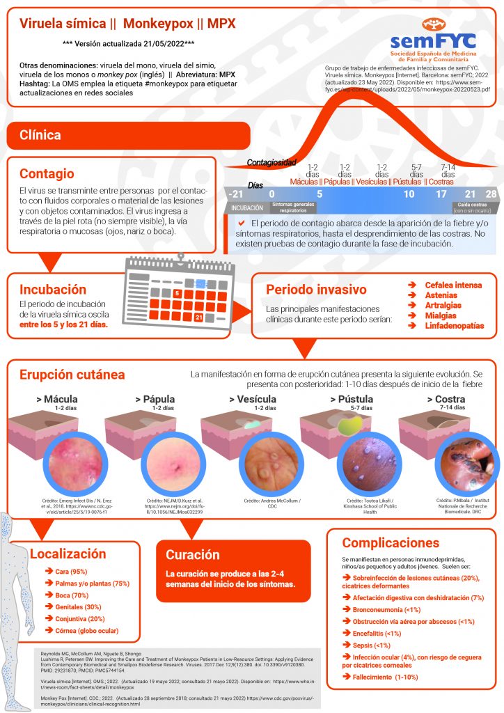 Grupo de trabajo de enfermedades infecciosas de semFYC. Viruela símica. Monkeypox 2